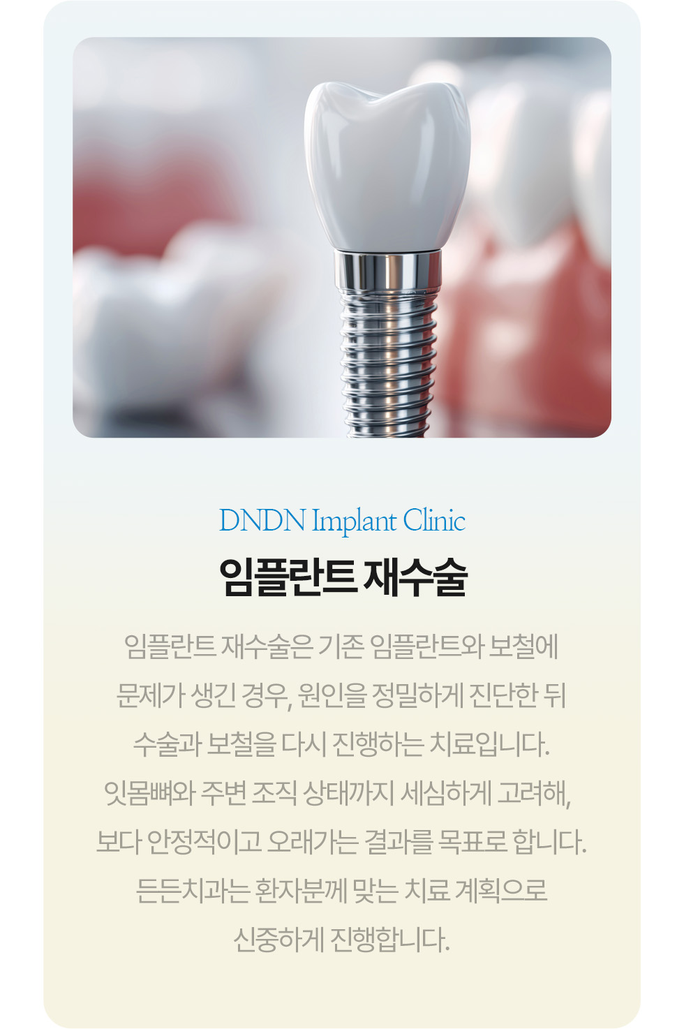임플란트 재수술