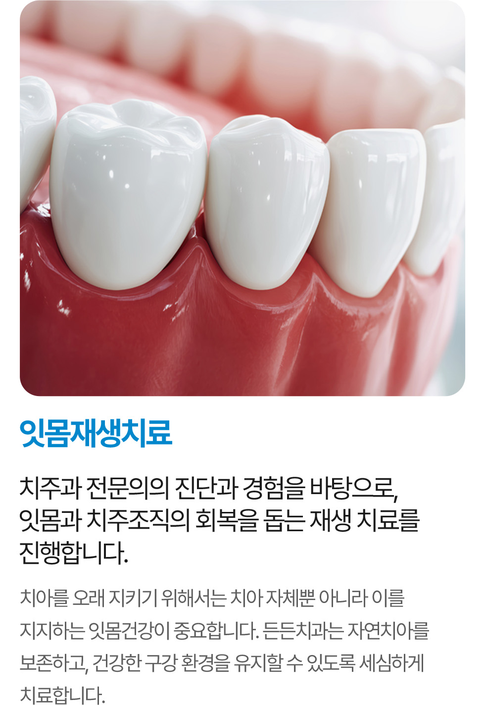 잇몸재생치료