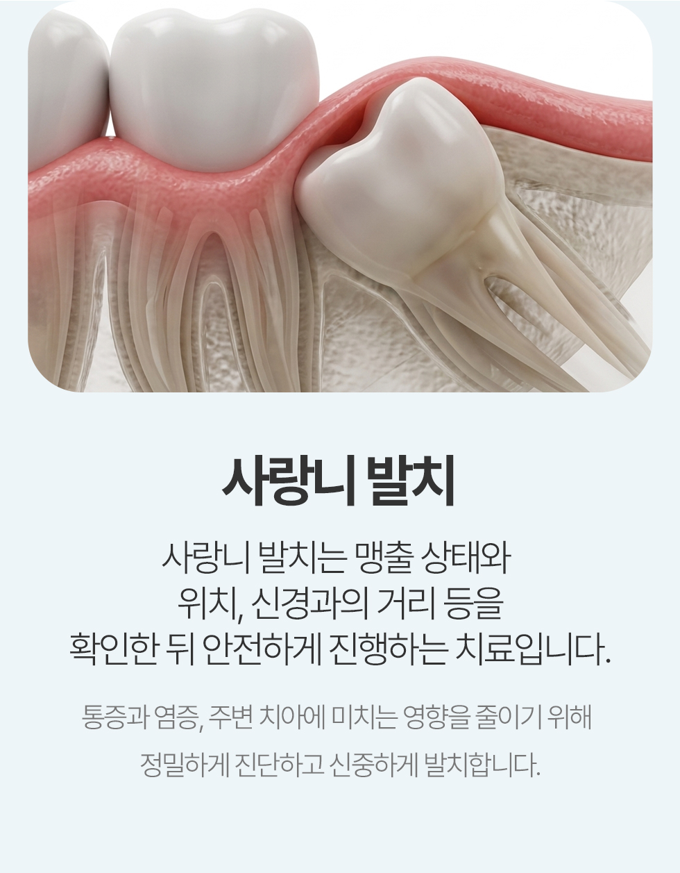 사랑니발치