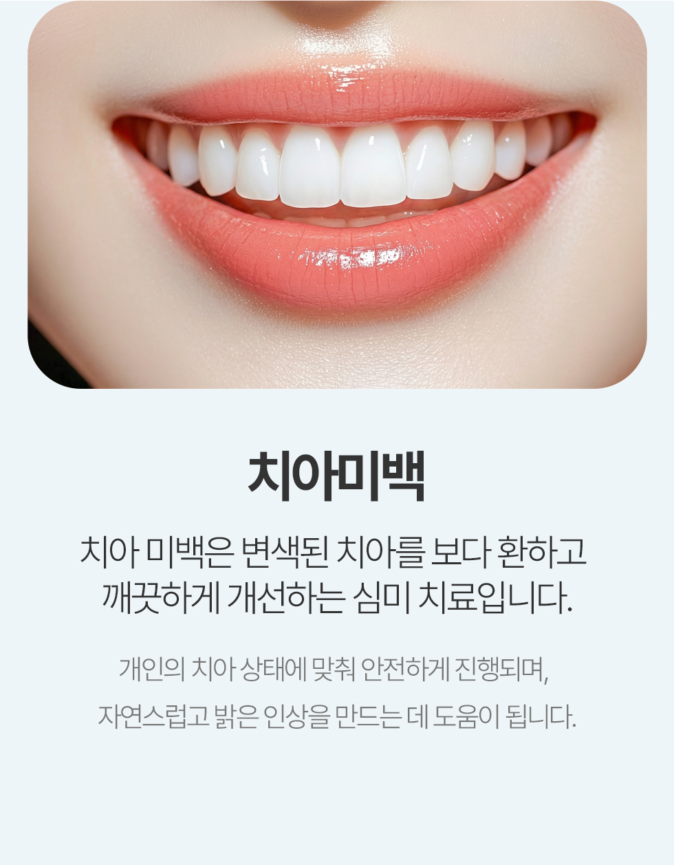 치아미백