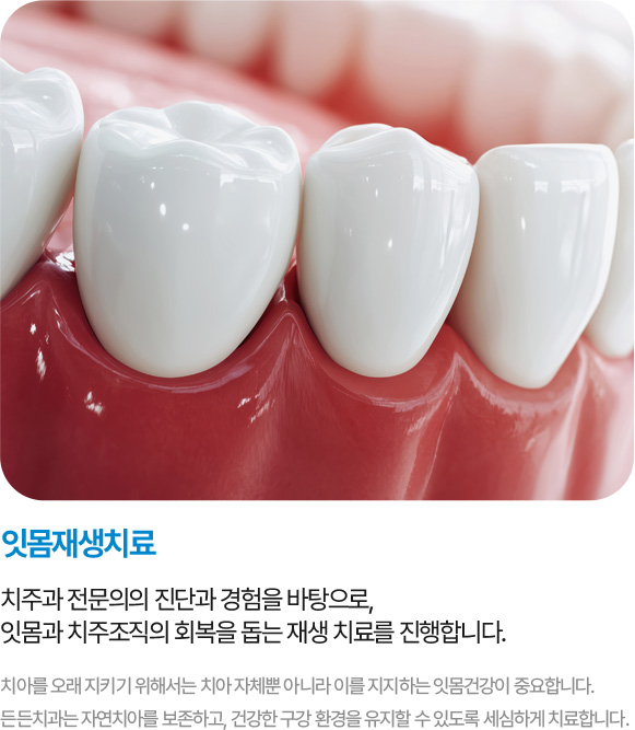 잇몸재생치료