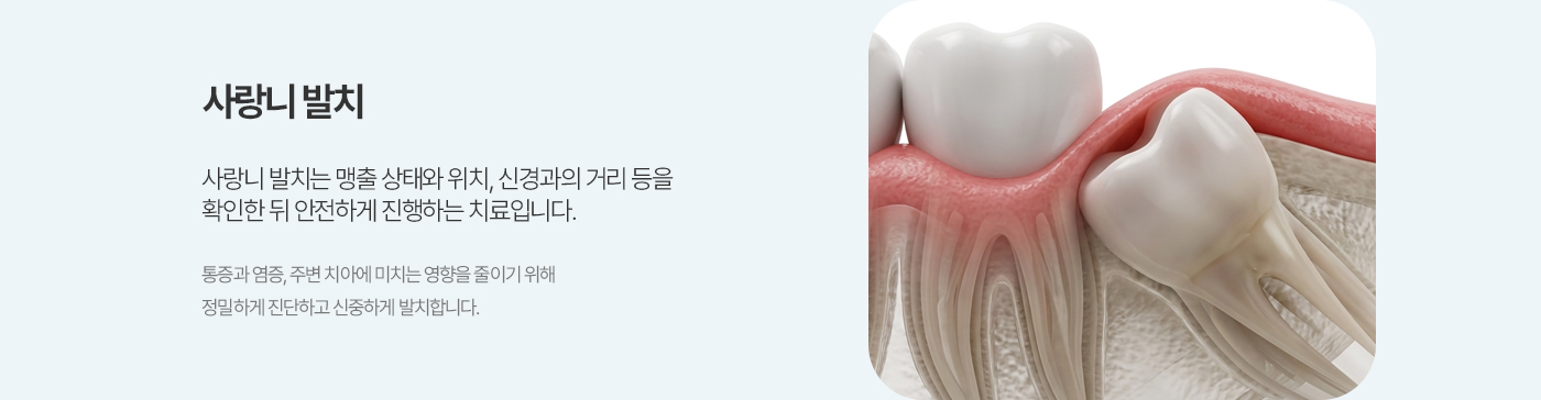 사랑니발치